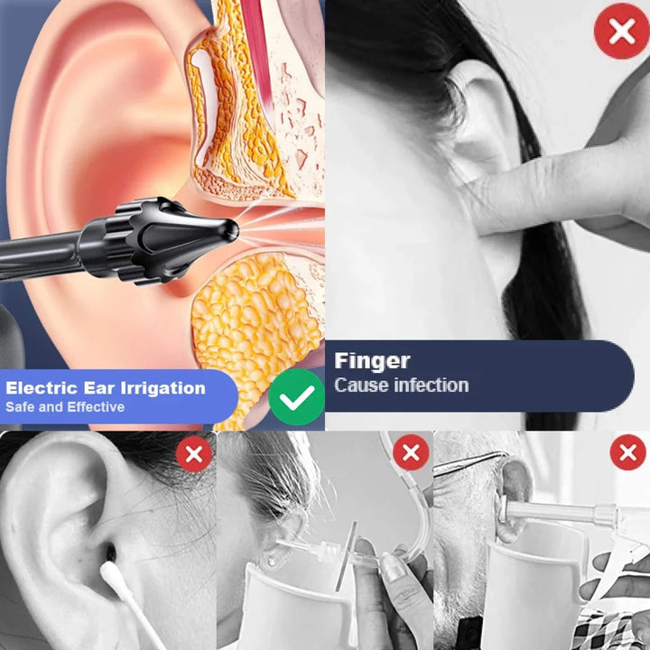 Rechargeable Ear Cleaning Irrigation Tool with 3 Pressure Settings